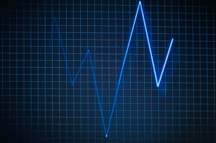 EKG